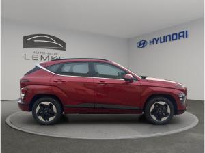 Hyundai Kona Elektro 🔋⚡️65,4kWh ⚡️ SELECT‼️‼️ AKTIONSLEASING‼️‼️