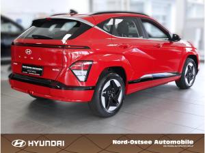 Hyundai KONA Elektro 🖤💛10 Jahre HYUNDAI x NOA 💛🖤 49kWh